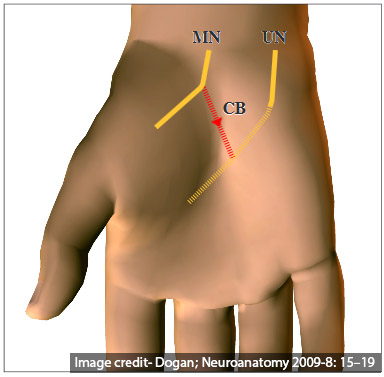 Riche-Cannieu anastomosis [CB- Connecting Branch]