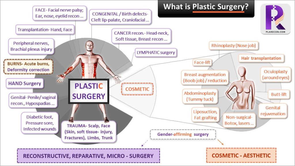 Plastic surgery procedures - PlaRecon infographic
