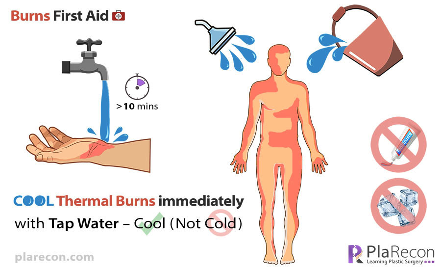 chemical burn first aid