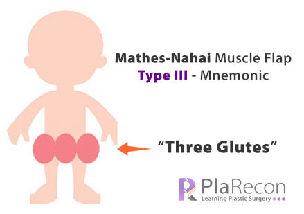 Mathes Nahai class III mnemonic