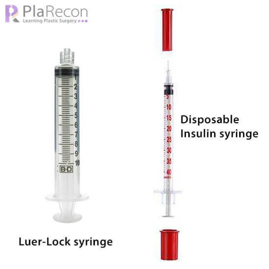 Keloid- intralesional steroid injection syringes