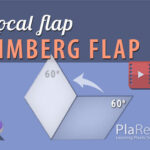 Limberg rhombic flap design planning procedure